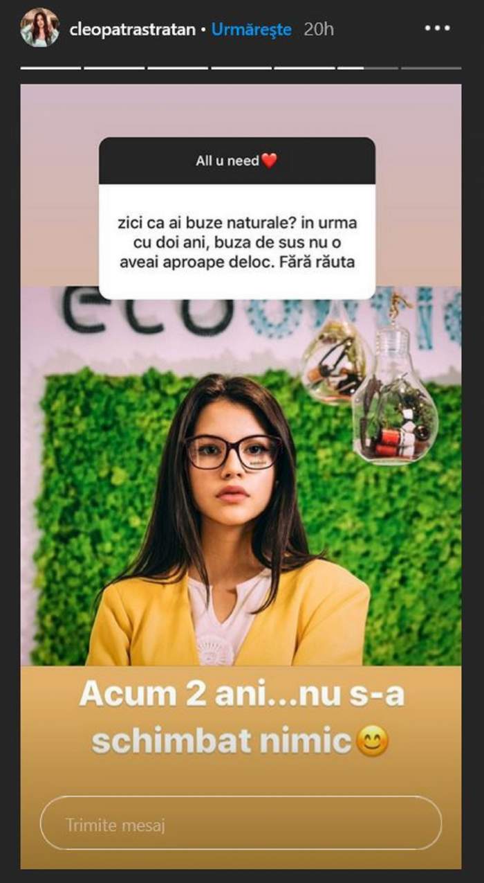 Cleopatra Stratan dă cărțile pe față! A apelat sau nu artista la operații estetice: „Înainte, buza de sus nu o aveai aproape deloc”