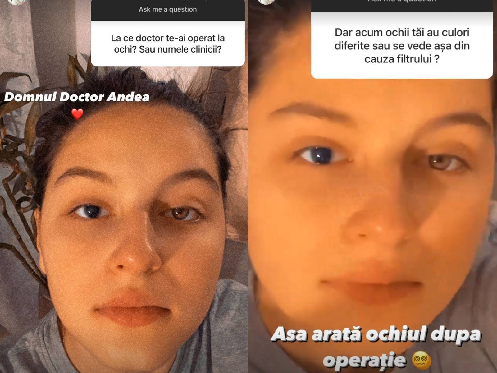 Carmina Vârciu a ajuns pe mâna medicilor pentru a se opera la ochi. Ochii ei au acum culori diferite în urma intervenției